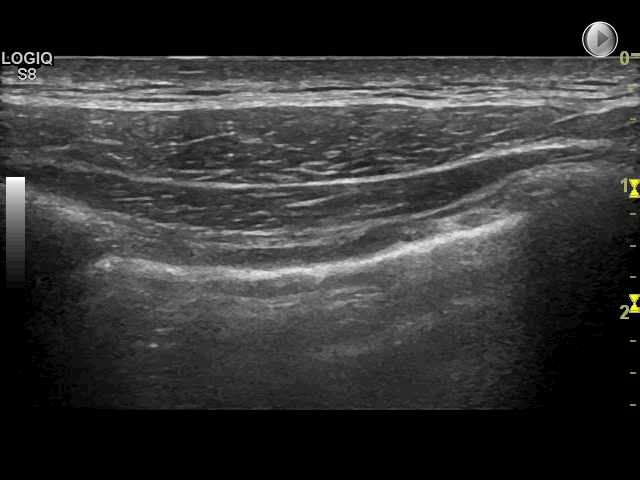 EEU case image missing